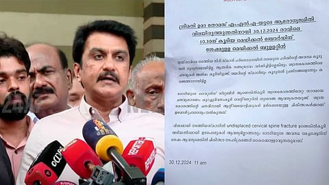 ഉമ തോമസ് വെന്റിലേറ്ററില് തുടരും;  ശ്വാസകോശത്തിനേറ്റ ചതവുകള് കൂടി, ആന്തരിക രക്തസ്രാവം വര്ധിച്ചിട്ടില്ല: മെഡിക്കല് ബുള്ളറ്റിന്