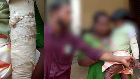 'മൂന്ന് വയസുകാരിയുടെ കൈ പിടിച്ച് തിരിച്ചു'; താമരശ്ശേരിയിലെ അങ്കണവാടി അധ്യാപികക്കെതിരെ പരാതിയുമായി കുടുംബം