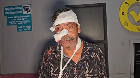 മദ്യവിൽപനയെ ചൊല്ലി തർക്കം; താമരശേരിയിൽ മധ്യവയസ്കന് ക്രൂരമർദനം