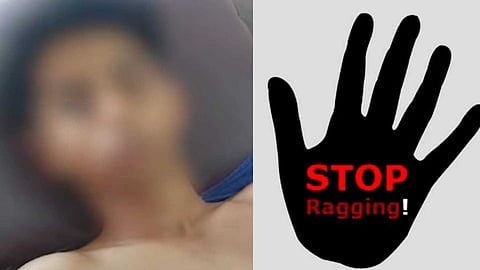 "നോട്ടം ശരിയല്ലെന്ന് പറഞ്ഞ് നിലത്തിട്ടുചവിട്ടി, കൈ തിരിച്ച് ഒടിച്ചു"; കണ്ണൂരിൽ പ്ലസ് വൺ വിദ്യാർഥിയെ സീനിയേഴ്സ് ക്രൂരമായി മർദിച്ചെന്ന് പരാതി