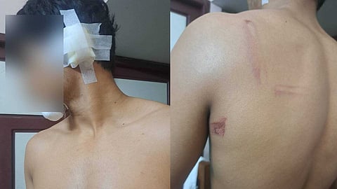 കുന്നംകുളത്ത് പ്ലസ്ടു വിദ്യാർഥിയെ ജൂനിയർ വിദ്യാർഥികൾ മർദിച്ച സംഭവം: ഹോസ്റ്റൽ വാർഡനെതിരെ ആരോപണവുമായി കുട്ടിയുടെ അമ്മ