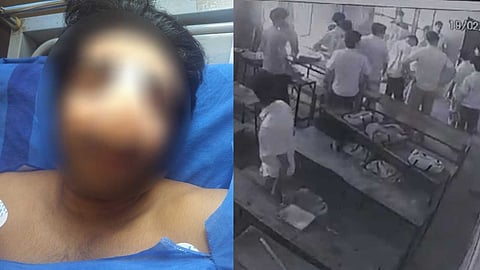 "മൂക്കിൻ്റെ പാലം രണ്ടര സെൻ്റീമീറ്റർ അകത്തേക്ക് പോയി, തമ്പോല ടീം നേരിടുമെന്ന് ഭീഷണിപ്പെടുത്തി"; സാജൻ്റെ ആരോഗ്യസ്ഥിതി അതീവ ഗുരുതരമെന്ന് കുടുംബം