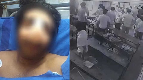 വിദ്യാർഥിയുടെ മൂക്കിൻ്റെ പാലം തകർത്ത സംഭവം: 'കേസ് ഒതുക്കി തീർക്കാന് ശ്രമം'; കുട്ടിയുടെ മൊഴിപോലും എടുത്തില്ലെന്ന് പിതാവ്