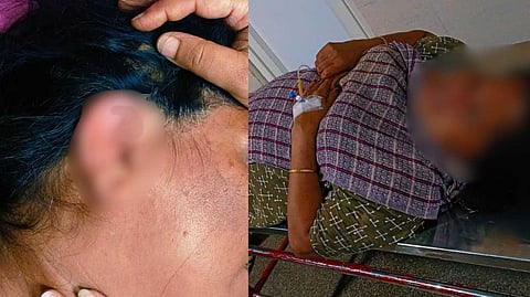 'വയറിന് ചവിട്ടി, കുക്കറിന്റെ മൂടികൊണ്ടടിച്ചു'; കോഴിക്കോട് സ്വത്ത് തര്ക്കത്തിന്റെ പേരില് അമ്മയ്ക്ക് മകന്റെ ക്രൂര മര്ദനം