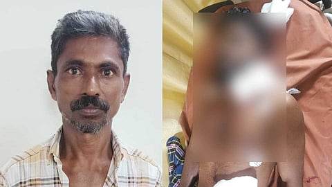 കോഴിക്കോട് തെരുവത്ത് ബസാറിൽ ലഹരിക്കടിമയായ പിതാവ് മകനെ കഴുത്തറുത്ത് കൊല്ലാൻ ശ്രമിച്ചു; അത്താണിക്കൽ ബീച്ച് സ്വദേശി ജാബിർ കസ്റ്റഡയിൽ