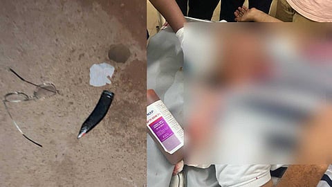 കാസർഗോഡ് പടക്കം പൊട്ടിച്ചത് ചോദ്യം ചെയ്ത നാല് പേർക്ക് വെട്ടേറ്റു; ഒരാളുടെ നില ഗുരുതരം