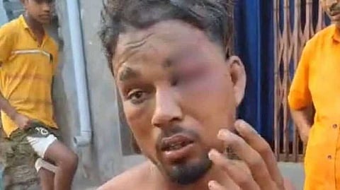 ഇതര സമുദായത്തിൽപ്പെട്ട 16കാരിയോട് സംസാരിച്ചു; ഛത്തീസ്ഗഢിൽ ദളിത് യുവാവിനെ നഗ്നനാക്കി മരത്തിൽ കെട്ടിയിട്ട് മർദിച്ചു