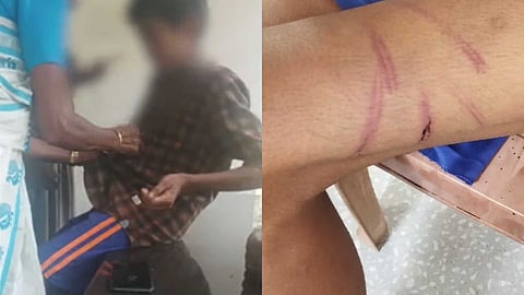 മരത്തിൽ കെട്ടിയിട്ട് മർദിച്ചു, അടിവയറ്റിൽ ചവിട്ടി; തിരുവനന്തപുരത്ത് പതിമൂന്നുകാരന് നേരെ മുത്തച്ഛൻ്റെ ക്രൂരത