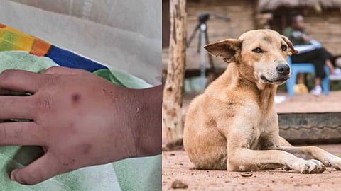 പത്തനംതിട്ടയിൽ പേവിഷബാധയേറ്റ് 13കാരി മരിച്ച സംഭവം: നായയെ വളർത്തിയ വീട്ടുകാർക്കെതിരെ കേസ്