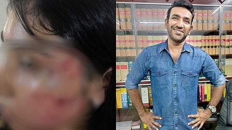 അഭിഭാഷകന്റെ അടിയില് ശാമിലി നിലത്ത് വീണു; എഴുന്നേറ്റപ്പോള് വീണ്ടും മുഖത്ത് ആഞ്ഞടിച്ചു; എഫ്ഐആറിന്റെ പകര്പ്പ് പുറത്ത്