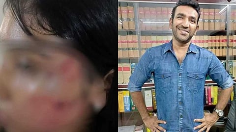 ''ബോധപൂര്വം ആക്രമിച്ചിട്ടില്ല''; ജൂനിയര് അഭിഭാഷകയെ മര്ദിച്ചെന്ന പരാതിയില് മുന്കൂര് ജാമ്യപേക്ഷയുമായി ബെയ്ലിന് ദാസ്