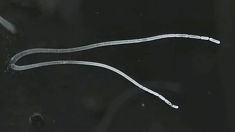 Thiomargarita magnifica