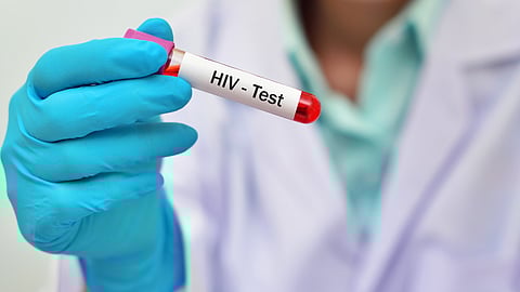 HIV