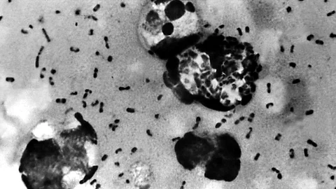 Bubonic Plague