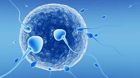IVF