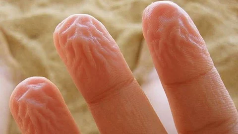 Why do our fingers and toes get wrinkly in water? Find out here