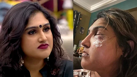 நடிகை வனிதா மீது மர்ம நபர் தாக்குதல் - பிக்பாஸ் பிரதீப் ஆதரவாளர் தான் காரணமா?
