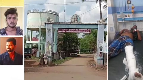 பாலியல் வன்கொடுமை கை, கால் முறிவு