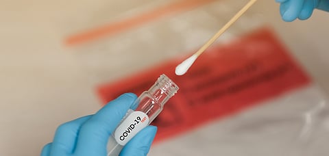 It is mandatory to submit a negative RT-PCR test report not older than 72 hours