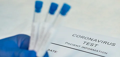 The test must be conducted within a maximum duration of 72 hours prior to departure