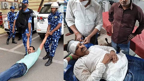 পুলিশের লাঠিচার্জে আহত বিধায়ক