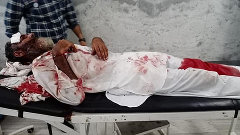 পুলিশের লাঠিচার্জে রক্তাক্ত এক কৃষক