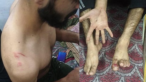 পাঞ্জাবে আক্রান্ত কাশ্মীরি ছাত্র