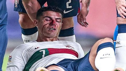 ক্রিশ্চিয়ানো রোনাল্ডো