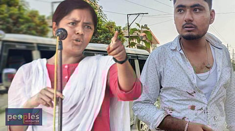 আক্রান্ত এস এফ আই নেতা অনিকেত মণ্ডল