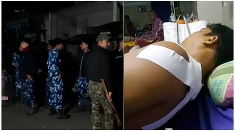 বসিরহাটে তৃণমূলের গোষ্ঠীদ্বন্দ্ব থামাতে গিয়ে গুলিবিদ্ধ পুলিশকর্মী