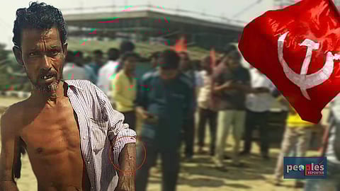 আক্রান্তদের মধ্যে একজন