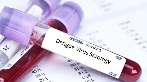 ডেঙ্গি চিকিৎসায় আশার আলো, নয়া কিট টেস্টে আগেই বোঝা যাবে প্লেটলেট কমবে কি না