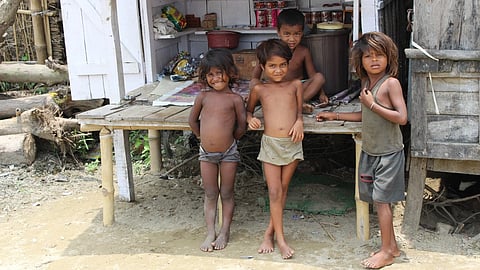 Gujarat: 'মডেল রাজ্য' গুজরাটে ৫.৭০ লক্ষেরও বেশি শিশু অপুষ্টির শিকার, বিধানসভায় জানালেন মন্ত্রী