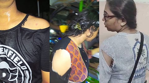 আহত আন্দোলনকারীরা