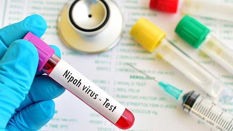 Nipah Virus: রাজ্যে নিপা ভাইরাস আক্রান্ত সন্দেহে হাসপাতালে ভর্তি ২ নার্স, অবস্থা সঙ্কটজনক