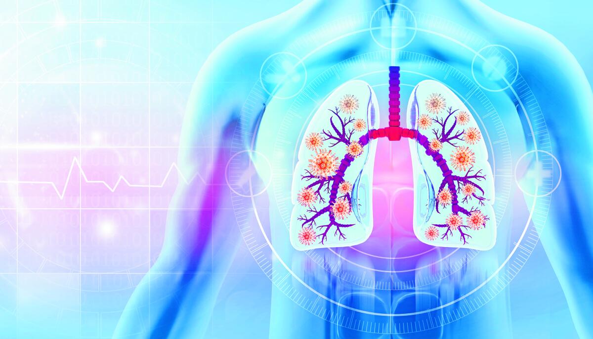 ಆಳ–ಅಗಲ | ಎಚ್ಎಂಪಿವಿ: ಸಾಮಾನ್ಯ ಸೋಂಕು ಅಪಾಯಕಾರಿ ಅಲ್ಲ