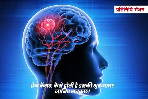 ब्रेन कैंसर: कैसे होती है इसकी शुरुआत? जानिए सबकुछ!