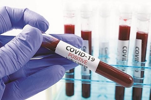 At forefront of providing essential services, oil PSUs see rise in COVID cases