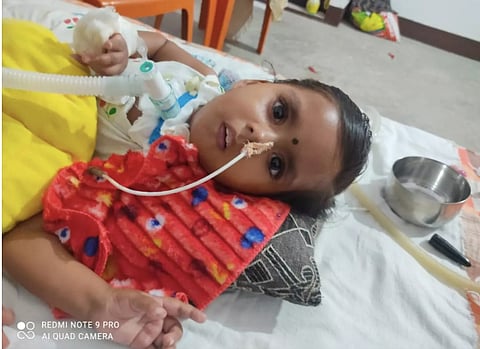 SECL to give Rs 16 crore for treatment of employee’s 2 year old daughter