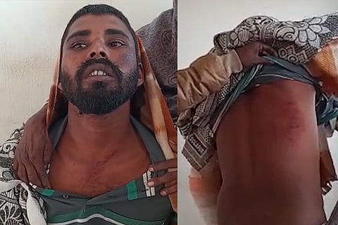 बीफ खाने से मना करने पर मुस्लिमों ने हिंदू शख्स को पीटा