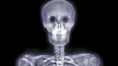 The story of how X-rays were discovered is very interesting.