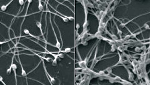 अमेरिकन संशोधकांनी बनवल्या गर्भनिरोधक अँटिबॉडी