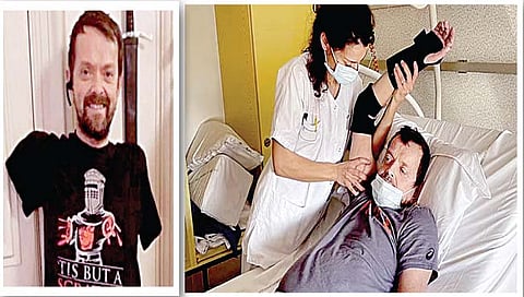 नवी दिल्ली : जगातील पहिली शस्त्रक्रिया, दोन्ही हातांचे केले प्रत्यारोपण