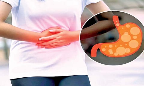 बद्धकोष्ठता : होमिओपॅथिक उपचार