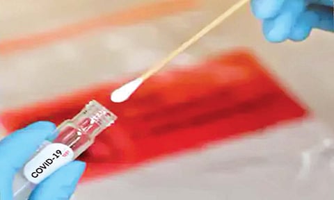 आरटी-पीसीआर पेक्षाही वेगवान कोरोना टेस्ट विकसित