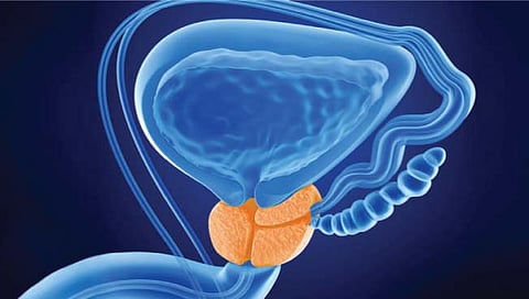 वाढलेले प्रोस्टेट आणि मूत्र विसर्जन समस्या