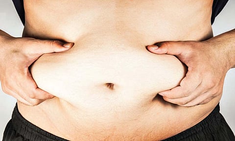 लठ्ठपणा संबंधित उपचार आणि व्यवस्थापन