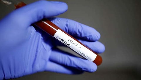 आरटीपीसीआर चाचणी आता साडेतीनशे रुपयांत; खासगी प्रयोगशाळांमधील दर पुन्हा कमी