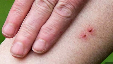 बीड : तिघींना सर्पदंश!, दोन चिमुकल्या मुलींचा मृत्यू, आईवर उपचार सुरु