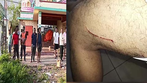 हडपसरमध्ये बिबट्याच्या हल्ल्यात तरुण जखमी; दहशतीचे वातावरण